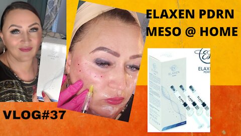 DIY ELAXEN PDRN MESOTHERAPY, USE DISCOUNT CODE NAT10.XOXO