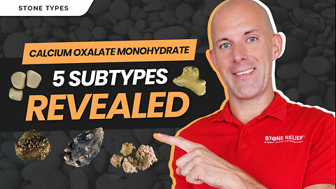 Calcium Oxalate Monohydrate Kidney Stones [Subtypes + Causes]