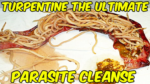 Turpentine The Ultimate Parasite Cleanse!