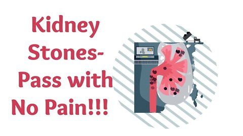 Pass Kidney Stones with No Pain