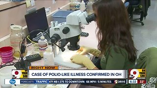 Cases of polio-like illness confirmed in Tri-State