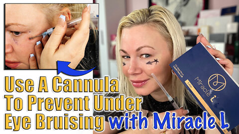 Use A Cannula to Prevent Under Eye Bruising with Miracle L Acecosm | Code Jessica10 Saves you Money!
