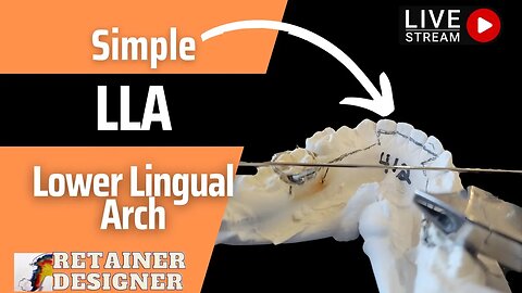 Live Stream: A Simple Lower Lingual Arch (LLA/LLHA)