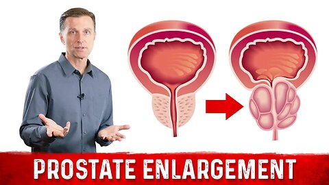 The Real Cause of Prostate Enlargement – Dr.Berg