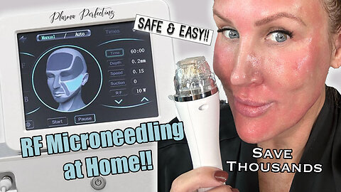 Professional RF Microneedling at Home // Full Tutorial