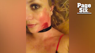 Britney Spears dresses up as bloody, murder victim for Halloween