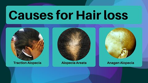 Causes of hair loss in black women | Different types of alopecia