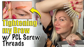 Tightening my Brow with PCL Screw Threads from AceCosm.com | Code Jessica10 Saves you Money! $$$