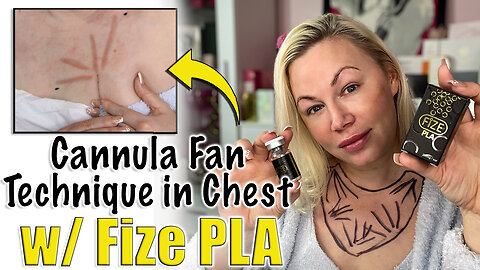 Cannula Fan Technique in Chest w/ Fize PLA from AceCosm.com | Code Jessica10 Saves you Money!