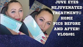 JUVE EYES REJUVENATING TREATMENT@ HOME.PICS BEFORE AND AFTER ACECOSM WITH CODE NAT10 VLOG#81#juveeye