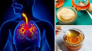 How to Use Onion as a Home Remedy for a Cough