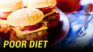 Poor Diet Now Kills More People Than Smoking