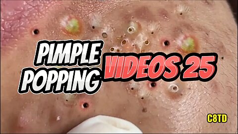 Satisfying Pimple Popping Videos 025