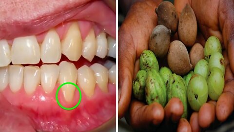 These 3 Fruits Can Fix Most of Your Gum and Teeth Issues