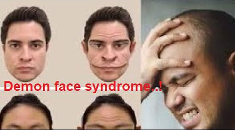 Demon face syndrome..! #demonfaces #mystery #mystery #views #usa #foryou #syndrome