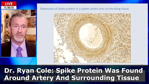 Dr. Ryan Cole: How Spike Protein Caused Aortic Aneurysm Rupture From Vaxxed People