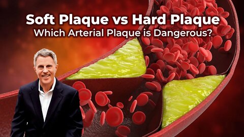 Soft Plaque vs Hard Plaque - Which Arterial Plaque is Dangerous?