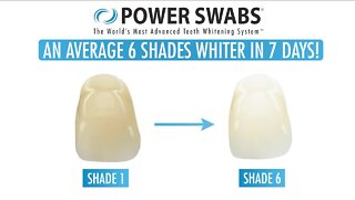 Achieve Whiter Teeth // Power Swabs
