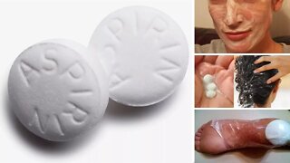 7 Surprising Uses for Aspirin