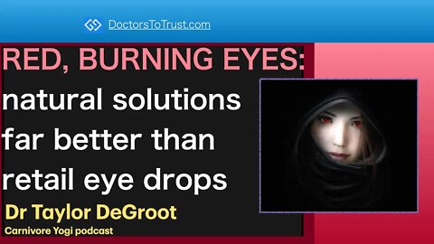 TAYLOR DEGROOT 3 | RED, BURNING EYES: natural solutions far better than retail eye drops