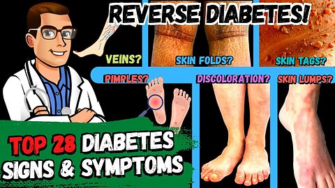 9 Diabetic Skin Problems That Indicate Diabetes