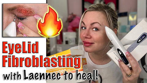 DIY Fibroblasting Eyelids to Tighten w/ Laennec to Heal, AceCosm | Code Jessica10 Saves you Money