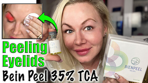 Fix Hooded Eyes w/ Bein 35% TCA Eye Lid Peel AceCosm| Code Jessica10 saves you Money Approved Vendor