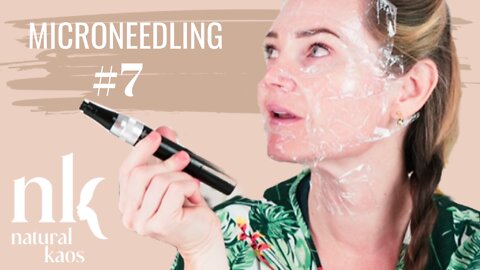 Microneedling at Home Session #7
