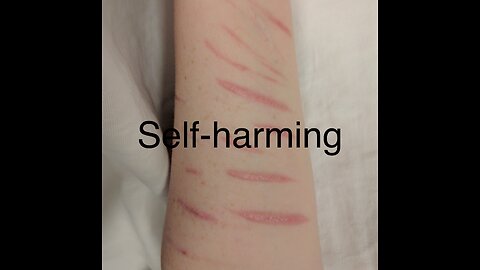 Self-Harming