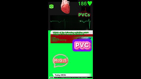 PVC #pvc #arrthymias #cardaic #heart prematureventricle tachycardia