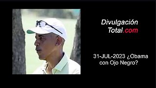 31-07-2023 ¿Obama con Ojo Negro?