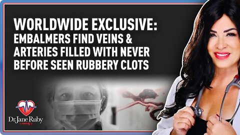 Embalmers finding veins, arteries filled with never before seen rubbery clots since mid 2021