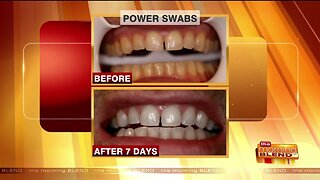 A Quick Routine to Get a Whiter, Brighter Smile