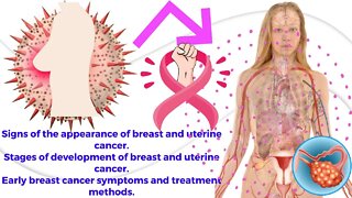 علامات ظهور سرطان الثدي I مراحل تطور سرطان الثدي و الرحم I اعراض سرطان الثدي المبكرة و طرق علاجه.