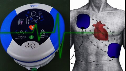 EEVblog #909 - Heart Defibrillator Teardown