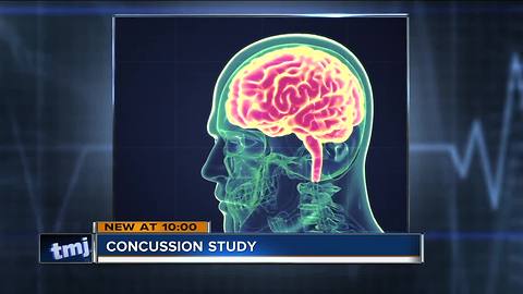 Girls and Concussions: UW-Madison study on protective head gear largest in the U.S.