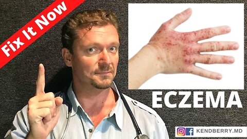 ECZEMA (Improve or Reverse Your Eczema NOW) 2021