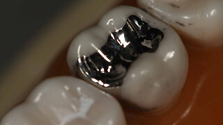 Are they using bone matrix for storing nanobots through teeth holes? Use only biological dentists!