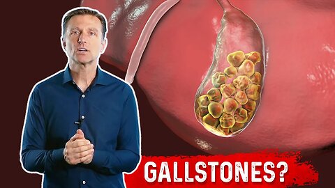 What is a Gallbladder Attack? – Symptoms & Causes Covered by Dr.Berg