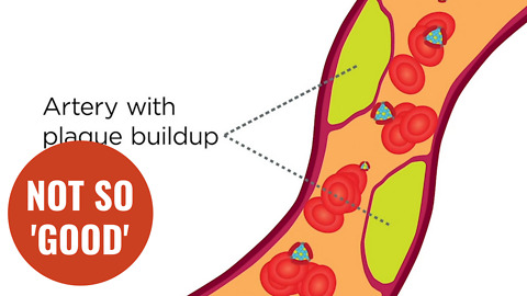 'Good' cholesterol may actually increase the risk of heart disease in older women