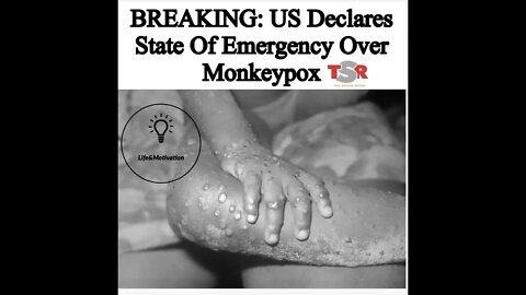 MONKEYPOX 😱 US Declares State Of Emergency Over MonkeyPox Virus