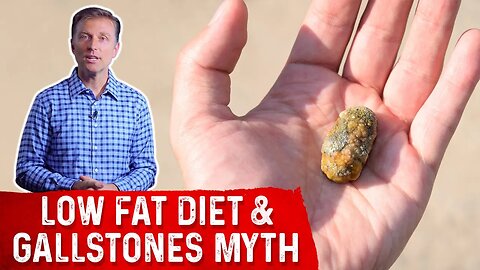 The Low Fat Diet to Prevent Gallstones "Myth" – Dr. Berg