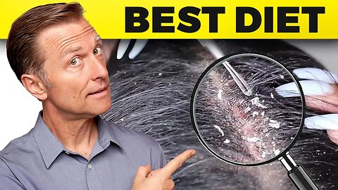 How to Get Rid of Dandruff Once and for All