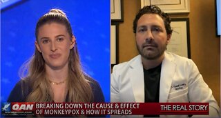 The Real Story – OAN Monkeypox Latest with Dr. Russell Surasky