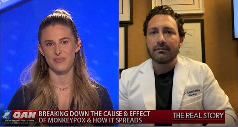 The Real Story – OAN Monkeypox Latest with Dr. Russell Surasky