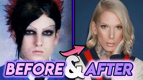 Jeffree Star Before & After Transformations 2020 Beauty Guru