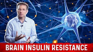 Dr. Berg Explains Brain Insulin Resistance