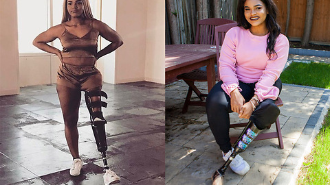 Empowered Teen Proud of Prosthetic Leg | SHAKE MY BEAUTY