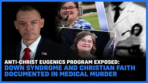 Eugenics Program Exposed: Down Syndrome And Christian Faith Documented In Medical Murder