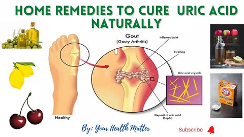 6 Best Home Remedies To Lower Uric Acid | Gout Naturally